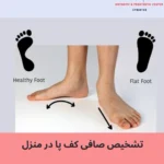 چگونه در خانه وضعیت سلامت کف پای خود را تشخیص دهیم؟
