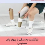 بازگشت به زندگی با پروتز پای مصنوعی